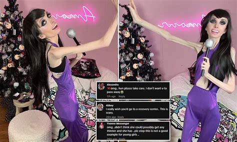 Anorexic Youtuber Eugenia Cooney Is Urged To Get Help After Showing Off Dangerously Thin