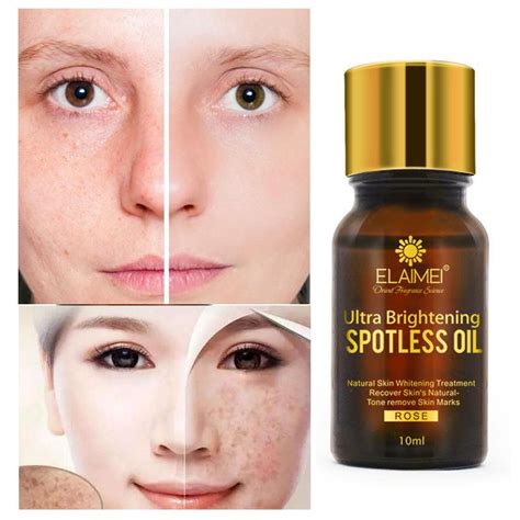 Buy 10ml Ultra Brightening Spotless Oil Skin Care Remove Ance Dark