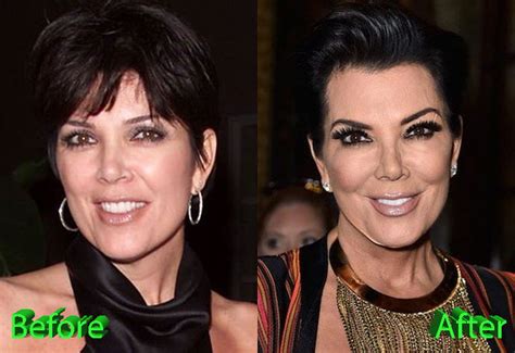 kris jenner plastic surgery a really beautiful granny