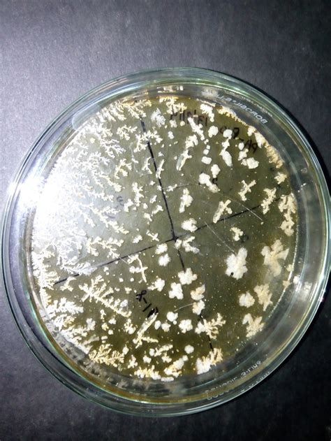 Pseudomonas aeruginosa is a type of germ that can cause infections in humans, mostly in hospital patients. Why when I incubate Pseudomonas in medium with cetrimide ...