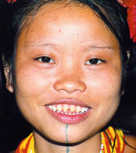Wild Kingdom Teeth In Tribal Asia