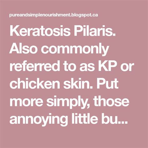Keratosis Pilaris Also Commonly Referred To As Kp Or Chicken Skin Put