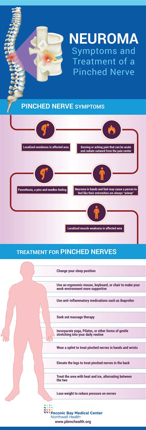 Neuroma Symptoms And Treatment Of A Pinched Nerve