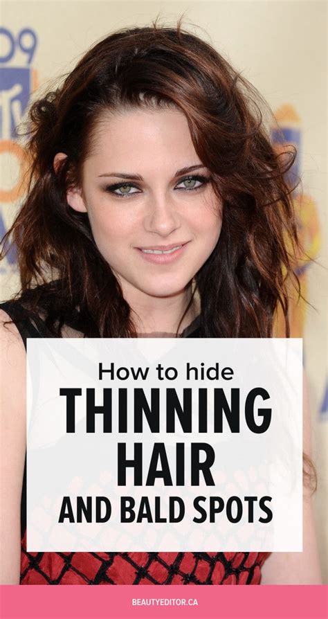 How To Hide Female Bald Spots A Complete Guide Best Simple Hairstyles