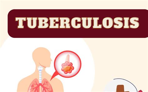 Cara Penularan Tuberkulosis Paru Pusat Layanan Kesehatan