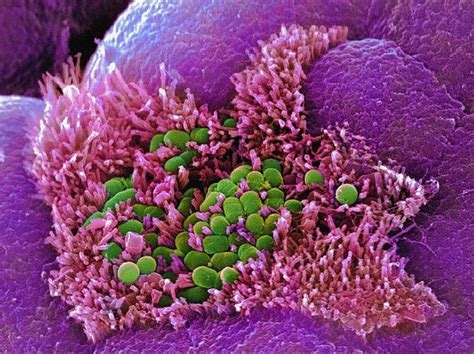 E Coli Bacteria Sem By Stephanie Schuller Microscopic Photography