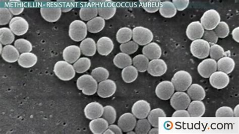 What Is A Staph Infection Causes Symptoms And Treatments Lesson