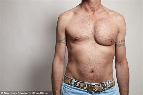 44 Year Old Left In Agony And With A Lopsided Chest After Implant