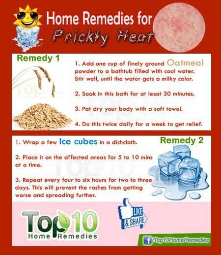 Home Remedies For Prickly Heat Top 10 Home Remedies Heat Rash