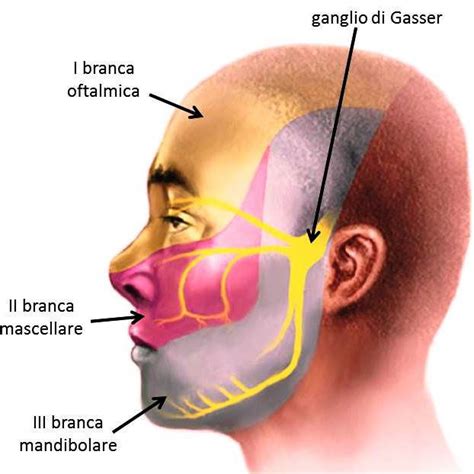La Nevralgia Trigeminale Cause E Sintomatologia