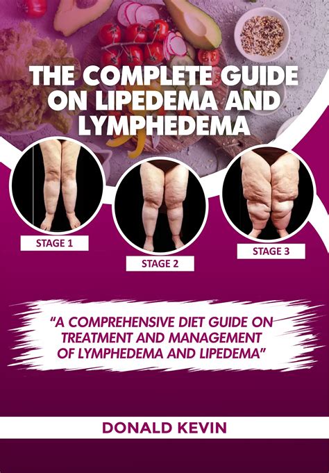The Complete Guide On Lipedema And Lymphedema A Comprehensive Diet