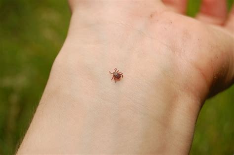 Your Tick Prevention Guide To Stay Bite Free This Summer