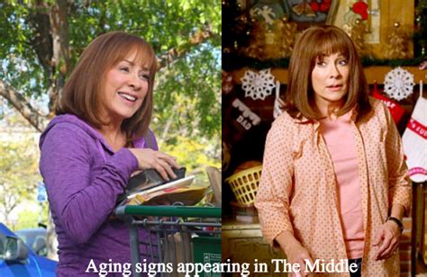 Patricia Heaton Plastic Surgery Before And After Photos