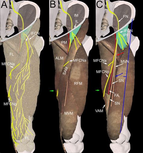 Lateral Femoral Cutaneous Nerve Location