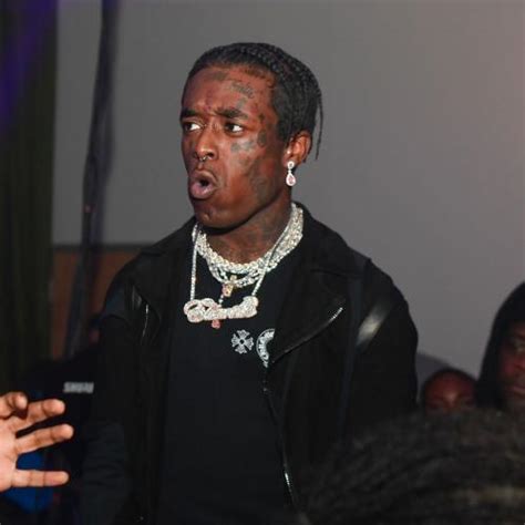 Lil Uzi Vert Implanted His 24 Million Diamond In His Forehead