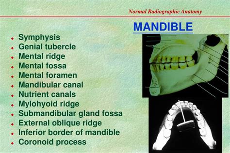 Ppt Normal Radiographic Anatomy Based On Intraoral Films Powerpoint