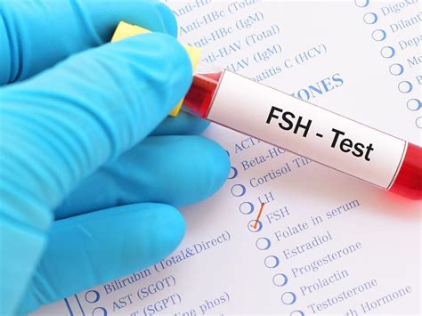 FSH poziom tego hormonu zdradza czy możesz zajść w ciążę