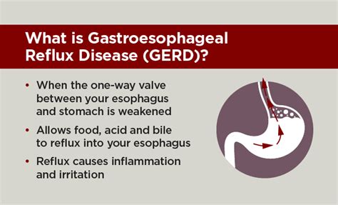 Gastroesophageal Reflux Disease Gerd Uchicago Medicine