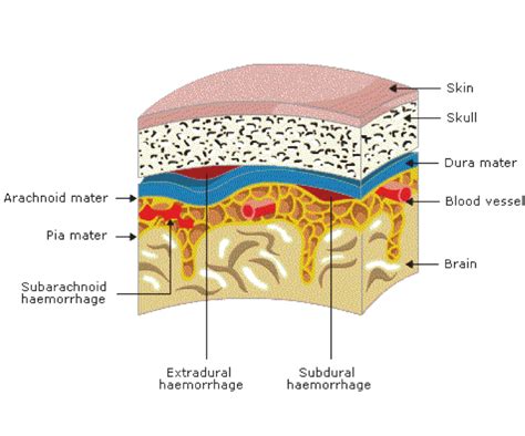 The Meninges Anatomy Of The Head And Brain Learn Surgery