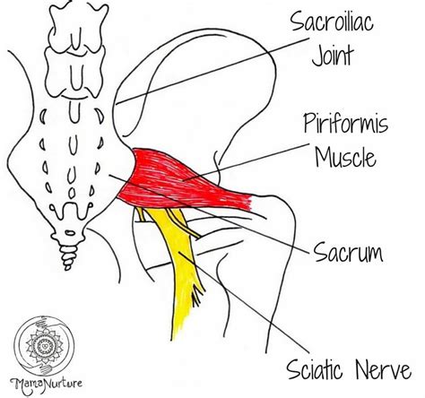 Piriformis Syndrome Occurs When The Sciatic Nerve Is Compressed By The Piriformis Muscle The