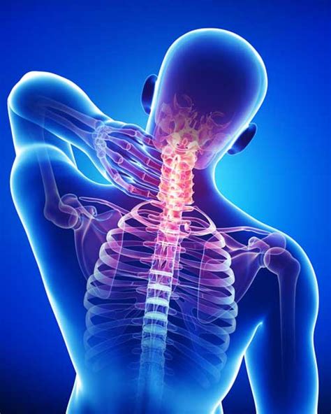 Neck And Mid Back Pain The Pain Relief And Wellness Clinic