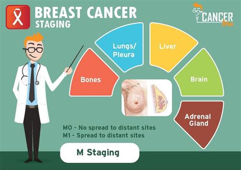 Breast Cancer Tnm Staging Explained Videos Infographic In Easy Way