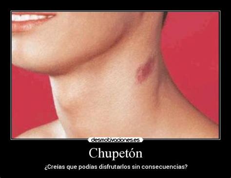 Check spelling or type a new query. Chupetón | Desmotivaciones