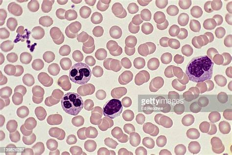 Red Blood Cell Microscope Bildbanksfoton Och Bilder Getty Images
