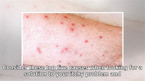 Red Bumps On Legs How To Recognize The Symptoms And Learn The