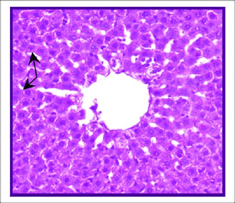 Photomicrograph Of Hematoxylin And Eosinstained Section Of