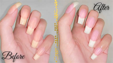 How To Whiten Nails In 5 Minutes Whiten Nails At Home Whiten Yellow Nails Youtube