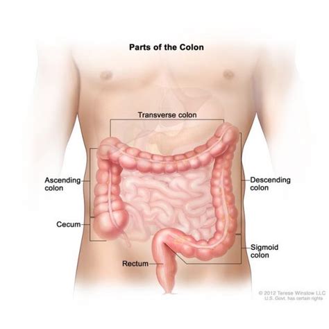 Colon And Rectal Cancer Cancerquest