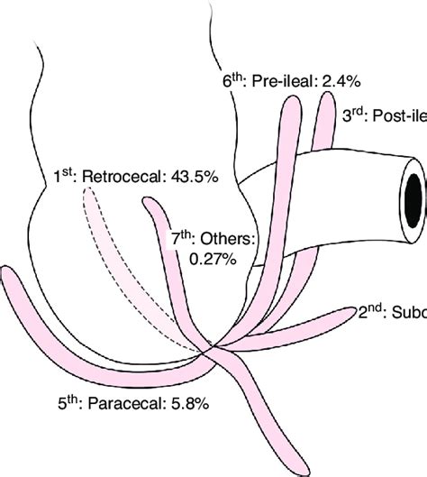 Positions Of The Vermiform Appendix Download Scientific Diagram