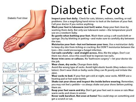 Symptoms Of A Diabetic Foot One Should Know Diabeticfeet For Your