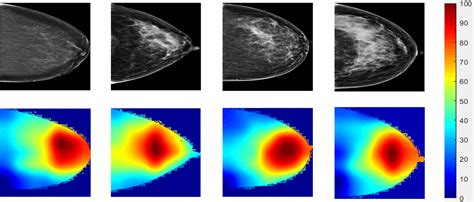 Deep Learning Modeling Using Normal Mammograms For Predicting Breast