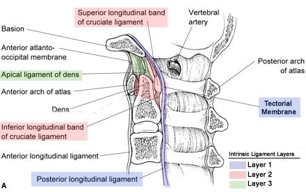 Atlas Fracture Transverse Ligament Injuries Spine Orthobullets