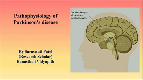 Pathophysiology Of Parkinsons Disease Youtube