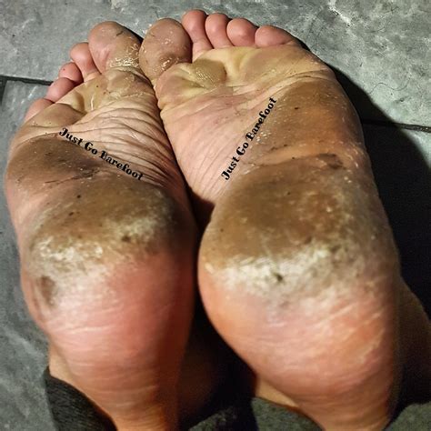 Calloused Crusty Cheesy Dirty Dry Feet And Rough Milf Soles Pics