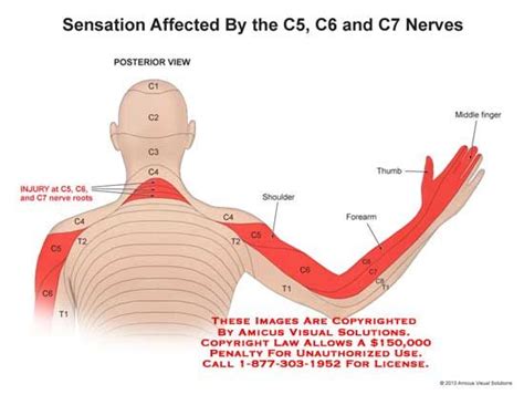 1312804x Sensation Affected By The C5 C6 And C7 Nerves Anatomy