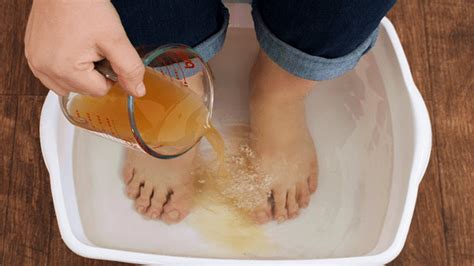 Soak Your Feet In Apple Cider Vinegar Results Will Shock You Youtube