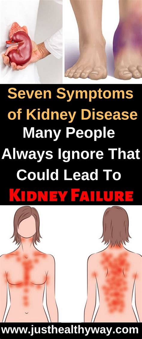 Seven Symptoms Of Kidney Disease Many People Always Ignore That Could