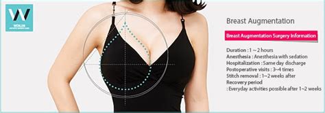 Attractive Breasts With Teardrop Breast Augmentation At Wonjin