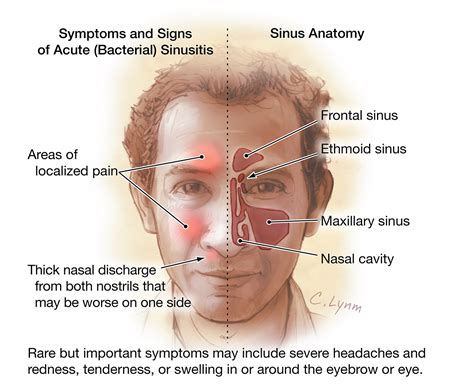 Sinus Cavities Anatomy