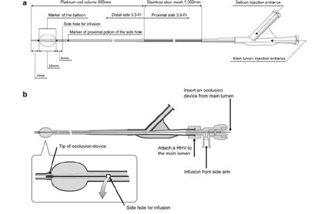 Double Lumen Microballoon Catheter A Diagram Of The Double Lumen