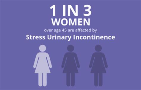 Stress Urinary Incontinence Dr William B Roth