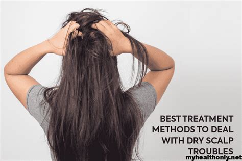 Dry Scalp Home Remedies How To Get Rid Of Dry Scalp