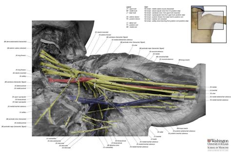 Brachial Plexus Peripheral Nerve Surgery Washington University In