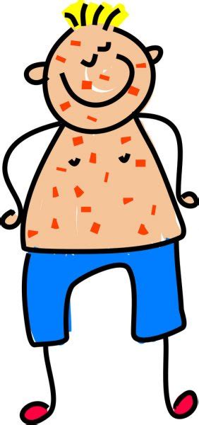 ᐈ Measles Stock Cliparts Royalty Free Measles Cartoon