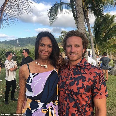 Turia Pitt Opens Up About Life Changing Fire That Saw Almost Burnt Her Alive Years On Daily