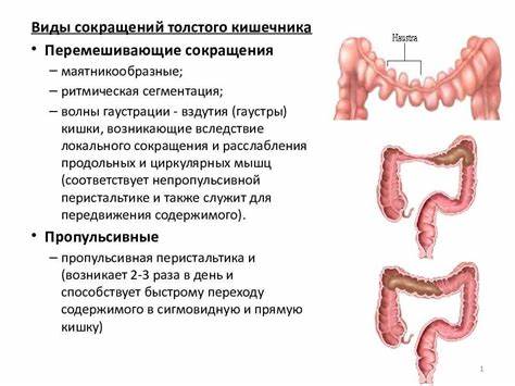 Хронический сигмоидит диета Симптомы воспаления сигмовидной кишки у женщин Симптомы воспаления сигмовидной кишки у женщин Хронический сигмоидит диета